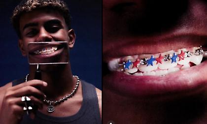 Το νέο χαμόγελο του Γιαμάλ: «Έντυσε» τα σιδεράκια του στα μπλαουγκράνα ενόψει Clasico!