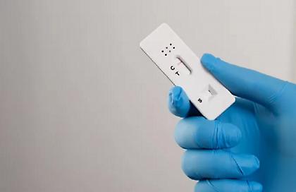 ΕΟΔΥ: 20 θάνατοι από COVID-19 την τελευταία εβδομάδα