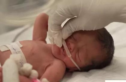 15χρονη γέννησε στην τουαλέτα νοσοκομείου στην Κατερίνη - Πίστεψε ότι απέβαλε και πέταξε το βρέφος στα σκουπίδια