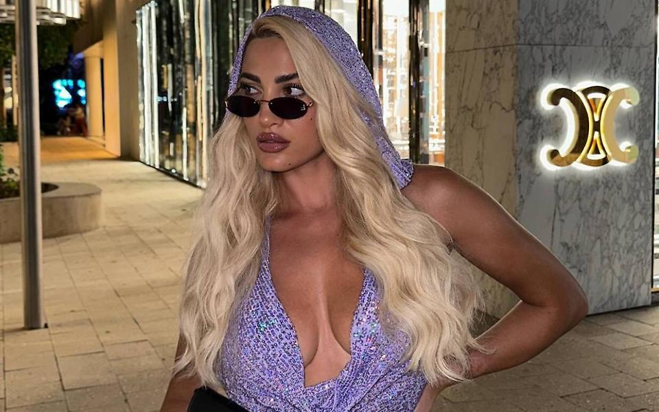 Ιωάννα Τούνη: Με ‘γεια τα καινούργια χείλη… «Ξέρω ότι τώρα φαίνομαι σαν πάπια»