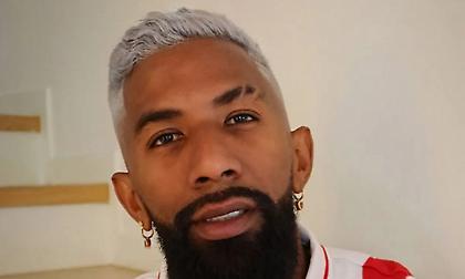 Έβαψε τα μαλλιά του και έκανε την αποκάλυψη του νέου του look μέσω social media ο Ροντινέι!