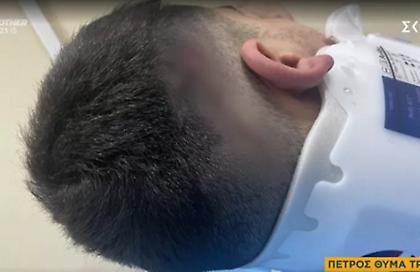 Τον χτύπησε με αυτοκίνητο και τον εγκατέλειψε