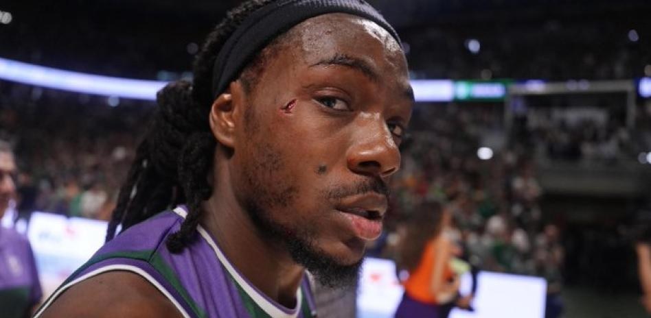 Το βαθύ σχίσιμο στο πρόσωπο του Πέρι από το αντιαθλητικό που έκρινε το Μάλαγα-Ρεάλ