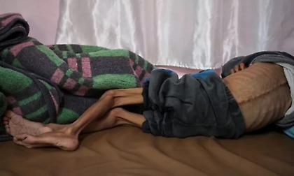 IPC: Η κρίση στη Γάζα έχει φτάσει σε θανάσιμη καμπή - Θυμίζει τους λιμούς της Αιθιοπίας και της Μπιάφρα