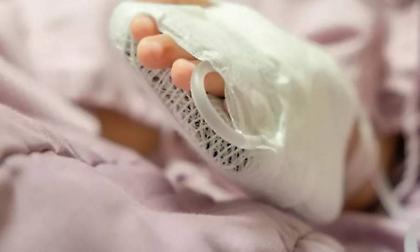 Χανιά: Βρέφος έπεσε από το μπαλκόνι - Νοσηλεύεται διασωληνωμένο με πολλαπλές κακώσεις