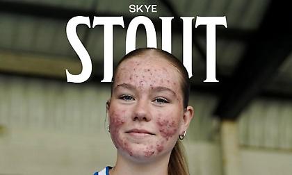 Η Κιλμάρνοκ έσβησε ποστ ανακοίνωσης 16χρονης παίκτριας γιατί έπεσε θύμα χλευασμού από οπαδούς