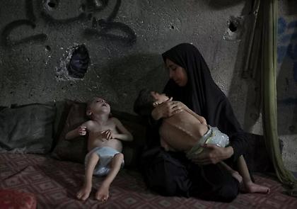 Επικίνδυνοι ιοί εξαπλώνονται στη Γάζα: Δεκάδες παιδιά με παράλυση λόγω έλλειψης τροφής και φαρμάκων