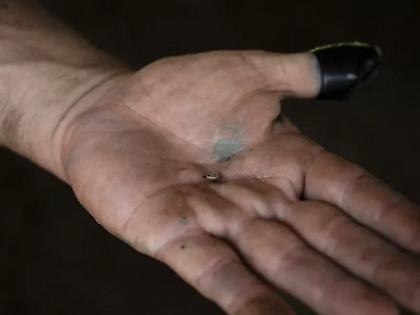 Οι ΗΠΑ επιβεβαίωσαν το πρώτο κρούσμα σε άνθρωπο του «σκουληκιού του Νέου Κόσμου»