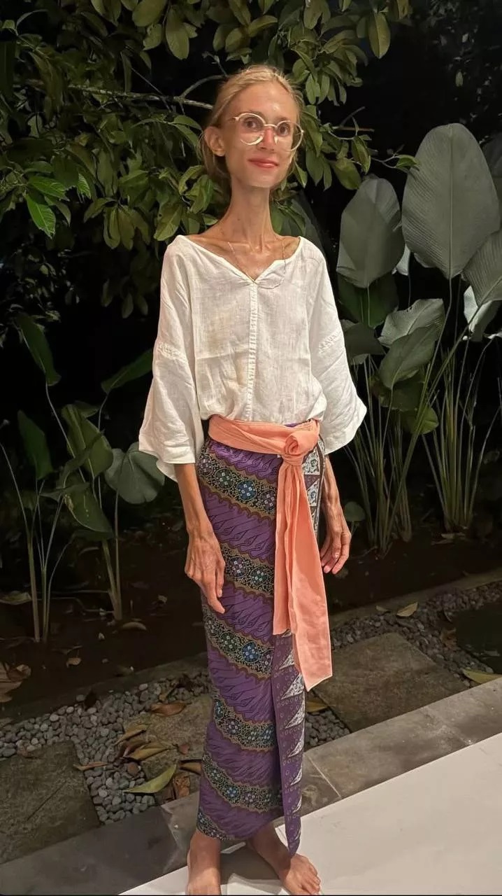 Όταν η «υγιεινή» διατροφή σκοτώνει: Vegan ωμοφάγος πέθανε ουσιαστικά από ασιτία