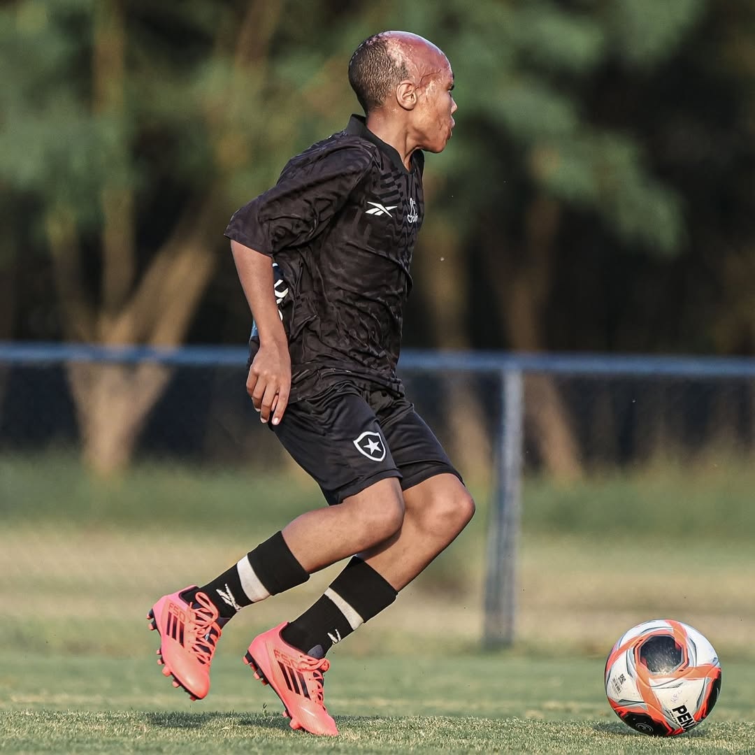 Μπερνάρντο, το παιδί-θαύμα της Μποταφόγκο που επέζησε από βαριά εγκαύματα και διαπρέπει