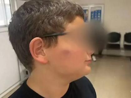 11χρονος ξυλοκοπήθηκε σε σχολείο στο Παλαιόκαστρο – Τι καταγγέλλει η μητέρα του