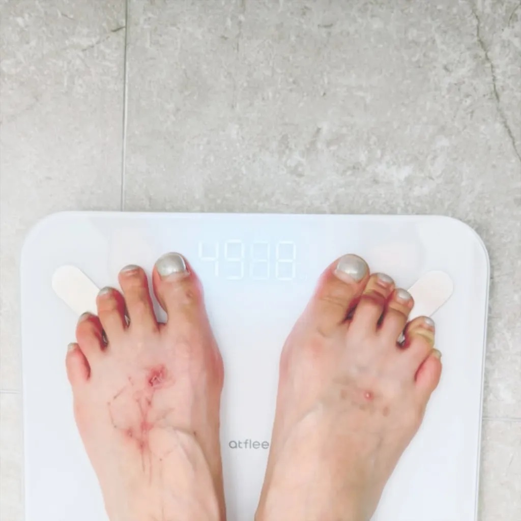 Η σταρ της K-pop, HyunA, κατέρρευσε στη σκηνή την ώρα που τραγουδούσε (video)