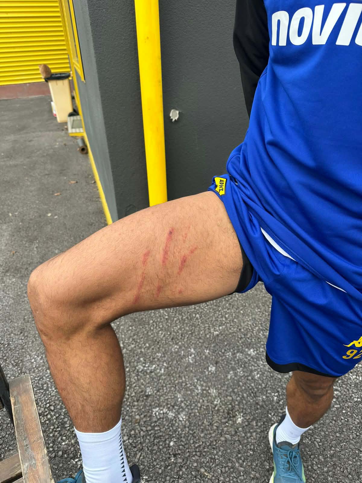 Άρης: Η σκαριά στο πόδι του Ρόουζ από το μαρκάρισμα του Ιβανούσετς