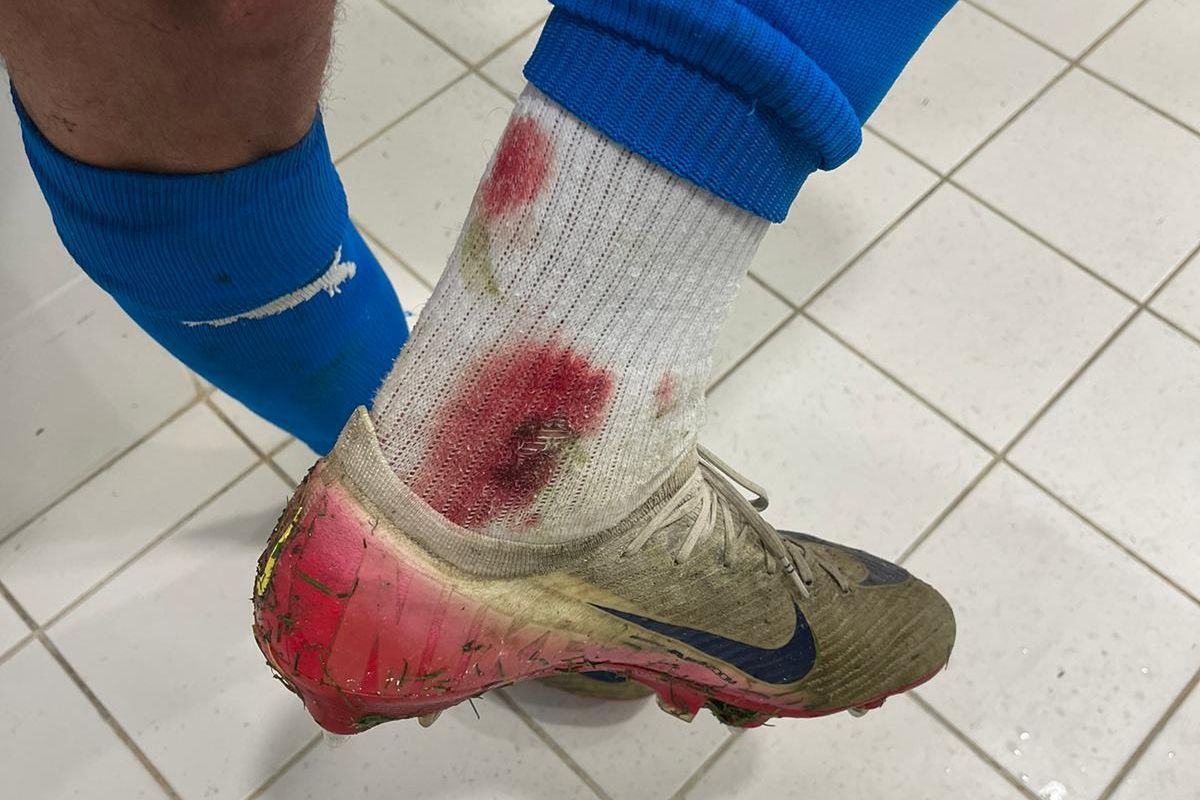 Κατηγορούν τη διαιτησία στην Κραϊόβα: «Εκτός ελέγχου, με αστείες αποφάσεις»