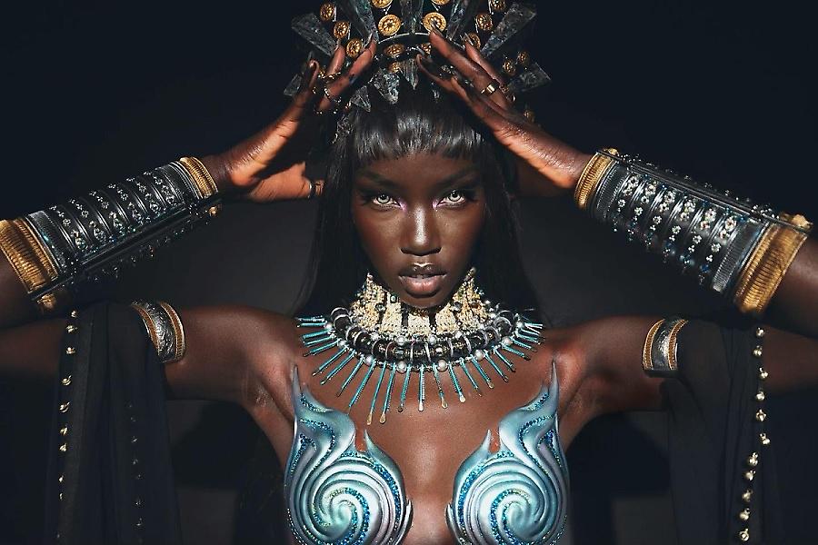 Anok Yai: Η σπάνια πάθηση που οδήγησε το Supermodel στο χειρουργείο και ο μακρύς δρόμος της ανάρρωσης