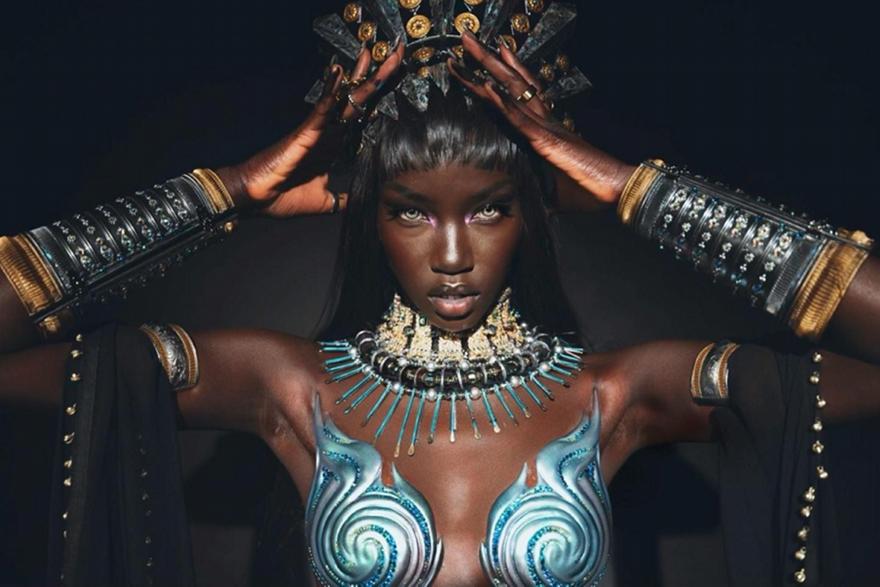 Anok Yai: Η σπάνια πάθηση που οδήγησε το Supermodel στο χειρουργείο και ο μακρύς δρόμος της ανάρρωσης