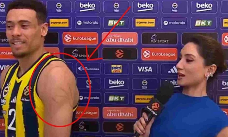 «Τυπικό ματς ελληνικής ομάδας»: Ο Μπόλντγουιν έδειξε στην κάμερα τις γρατζουνιές στο σώμα του