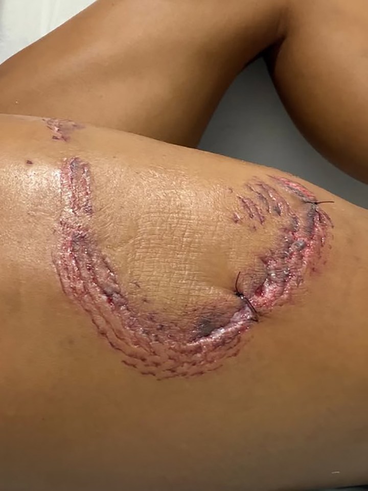 Βίντεο με καρχαρία να επιτίθεται σε γυναίκα ενώ έκανε κατάδυση στη Βραζιλία