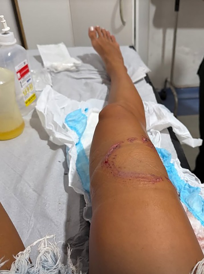 Βίντεο με καρχαρία να επιτίθεται σε γυναίκα ενώ έκανε κατάδυση στη Βραζιλία