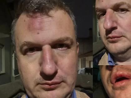 Θύμα άγριου ξυλοδαρμού ο εκδότης της εφημερίδας «Μαγνησία» στον Βόλο - «Οι τραμπουκισμοί δεν μας πτοούν»