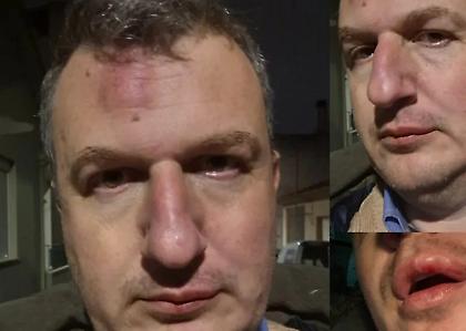 Εκδότης «Μαγνησίας» για τον ξυλοδαρμό του: «Η αστυνομία δεν προέβη ούτε στα αυτονόητα» - Ποιους καταγγέλει