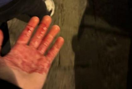 Μαχαιρώθηκαν δύο οπαδοί της Τσέλσι στη Νάπολη!