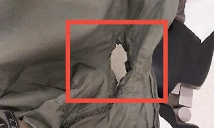 «Δολοφονική επίθεση»: Η στολή του αστυνομικού που τραυματίστηκε από τη βόμβα μολότοφ στο ΑΠΘ