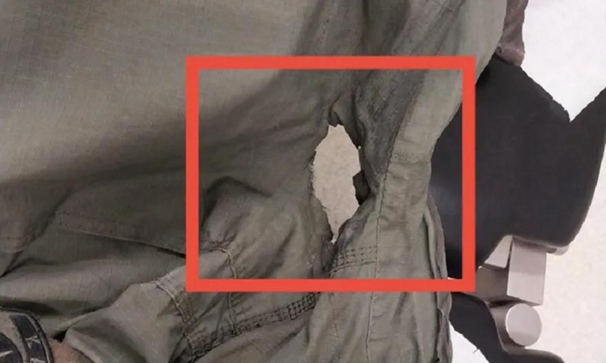 «Δολοφονική επίθεση»: Η στολή του αστυνομικού που τραυματίστηκε από τη βόμβα μολότοφ στο ΑΠΘ