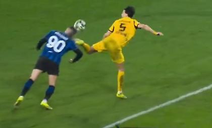 Η φωτογραφία του Κρστόβιτς από τ' αποδυτήρια της Αταλάντα μετά το τρομακτικό χτύπημα στο κεφάλι