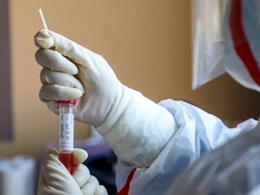Έμπολα: Περισσότερα από 2000 κρούσματα έχουν καταγραφεί στη ΛΔ Κονγκό