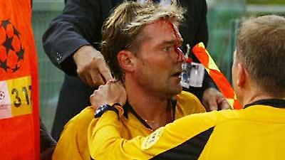 Φρισκ: «Φταίει η αστυνομία»