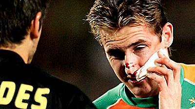 Αμφίβολη η συμμετοχή του Κλόζε με Τσέλσι