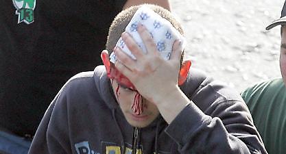 Στο νοσοκομείο τρεις ανήλικοι φίλαθλοι