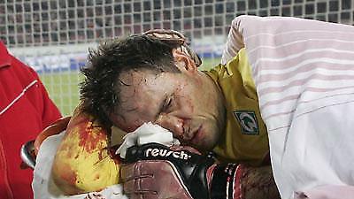 Κινδύνεψε η ζωή του Ράινκε!