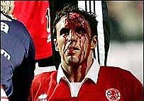 Το... παλεύει ο Σάουθγκεϊτ